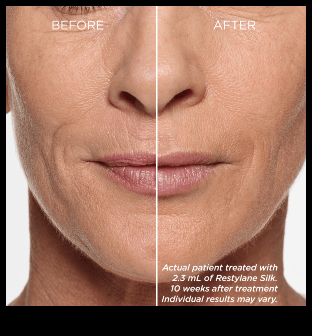 Lip Gloss και γήρανση 5 τρόποι για να ενισχύσετε τα ώριμα χείλη για μια νεανική εμφάνιση 3 Lip Gloss and Aging: Ενισχύοντας τα ώριμα χείλη για νεανική εμφάνιση